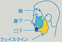 ひげ脱毛