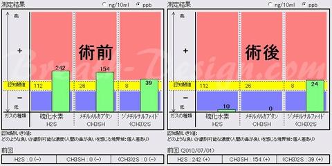 PMTC (歯のクリーニング)と口臭