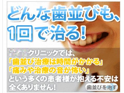 クイック矯正 セラミック矯正
