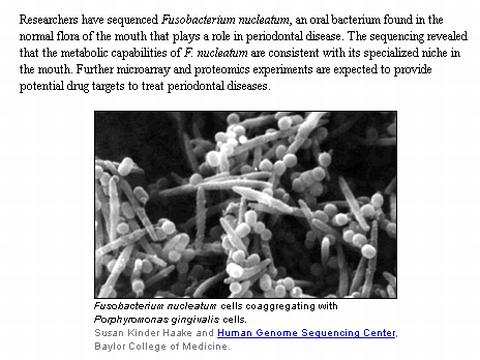F.nucleatum フゾバクテリウム