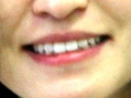 Korean Smile