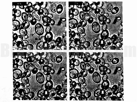 イースト 酵母 カビ カンジダ ピロリ菌 Yeast Candida H.Pyoli