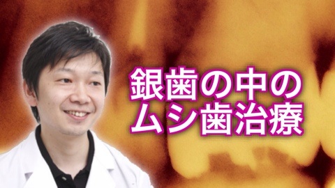 むし歯 ムシ歯 新潟 長岡