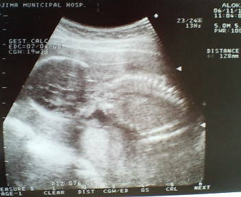 20061115_282099.jpg