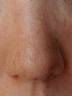 メモ75 超ゆる角質培養だいたい13週間目画像 id