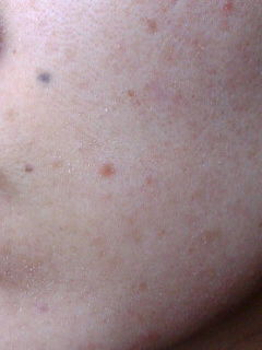 メモ75 超ゆる角質培養だいたい13週間目画像 id