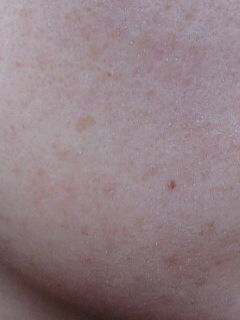 メモ55 角質培養だいたい9週間目画像 1リセットあり id