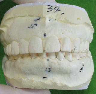 nem-2