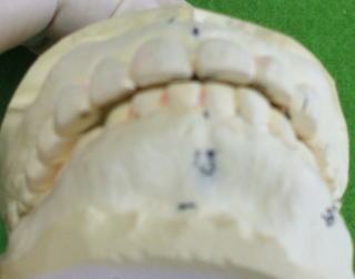 nem-3