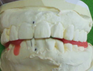 nem-5
