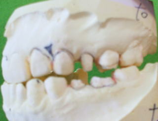 nonem-3