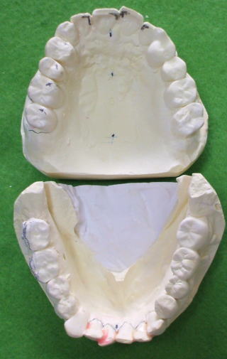 nomem-4