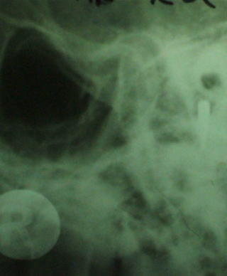 cross-9