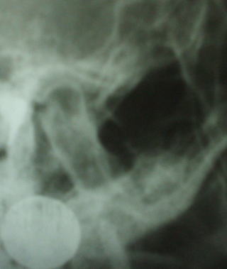 cross-10