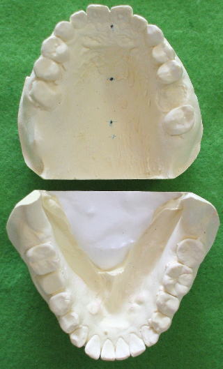 fugi-1