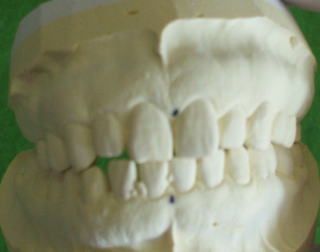 fugi-3