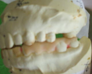 fugi-9