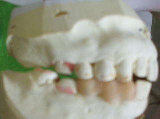 fugi-10