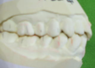 miyano-5