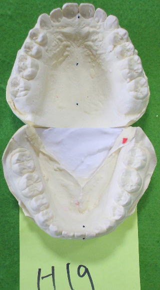 matu-2