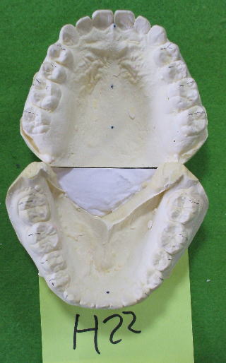 matu-3