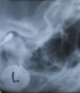 matu-5