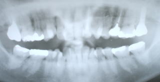 miyake-5