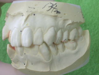 niyake-3