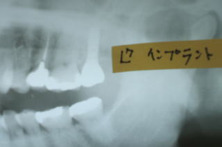 niyake-6