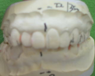 saka-1