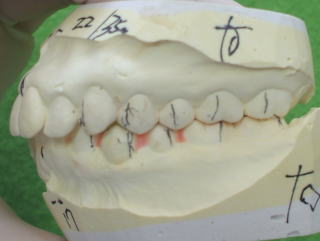 saka-2