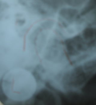 saka-6