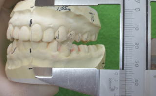 saka-8