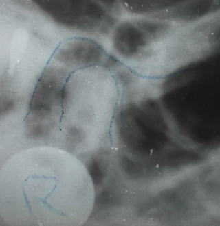 ¤¤¤±-5