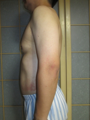 140806お腹