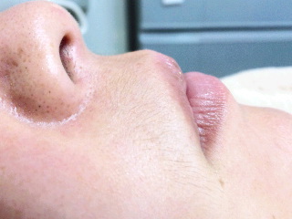 絹糸脱毛の効果 絹糸を使った産毛脱毛 交野市 枚方市 寝屋川市 京田辺市 まつげパーマ 全身脱毛 メンズヒゲ脱毛 Sally 内川恵美