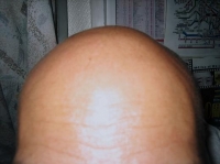 skinhead.JPG