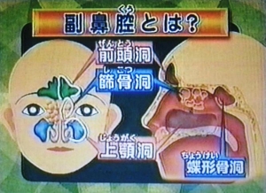 Bikuu0.JPG
