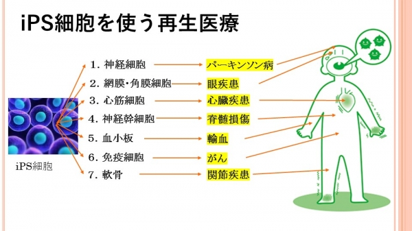 スライド1.JPG