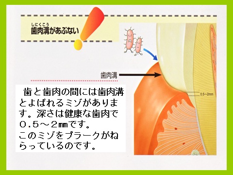perio003