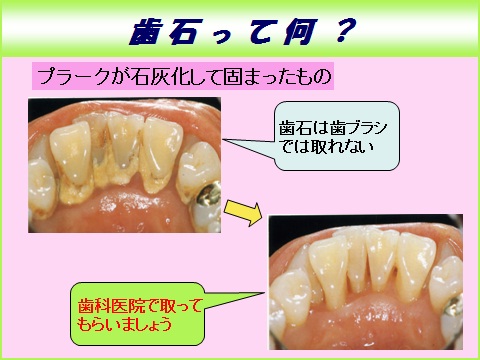 perio004