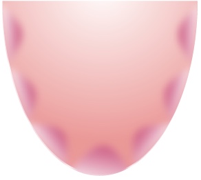 舌による診断