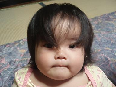 正面 befor