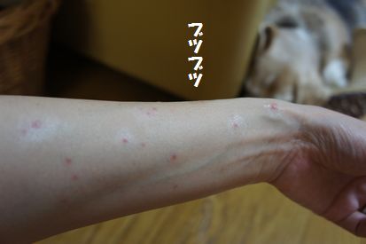 に 刺され た ダニ