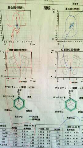 めまいの検査1