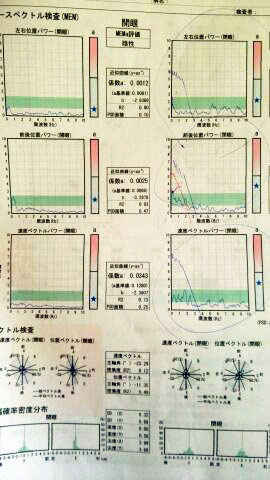 めまいの検査2