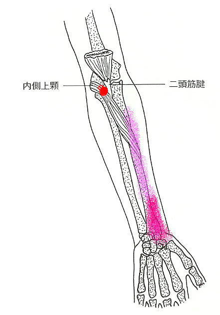 痛い 腕 の 筋 が