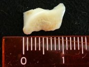 Éý1cm