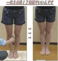 O脚