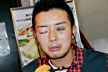 青たん。。。
